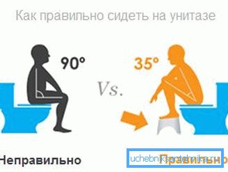 Auf dem Foto - die Position einer Person auf der Toilette während der Defäkation Auf dem Foto - die Position einer Person auf der Toilette während der Defäkation