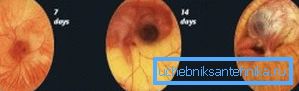 98 Entwicklung des Embryos im Ei