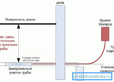 Das Schema der Verwendung des Esmarch-Bechers Das Schema der Verwendung des Esmarch-Bechers